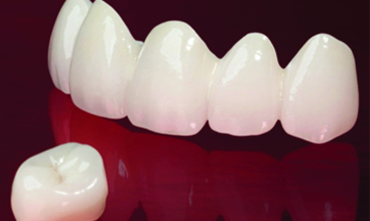 Zirconia dental crown benefits