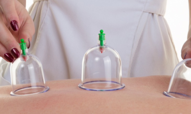 Benefit hijama for woman